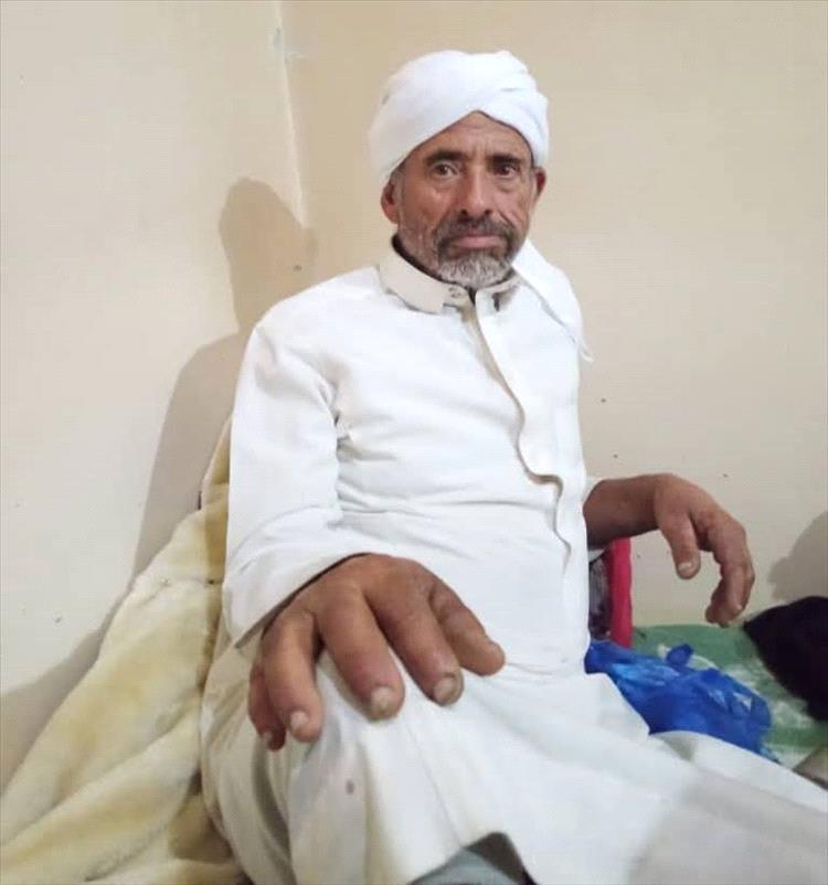 اعتداء مسلح في ساحة الحرية بتعز… مسن في غيبوبة بعد سرقته وسط مطالبات بملاحقة الجناة