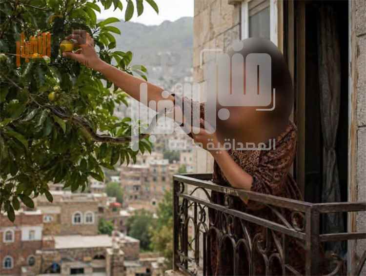لغز يثير الدهشة.. طفلة من تعز تنجو من 8 لدغات في الريف قبل أن يلدغها الثعبان للمرة التاسعة في المدينة