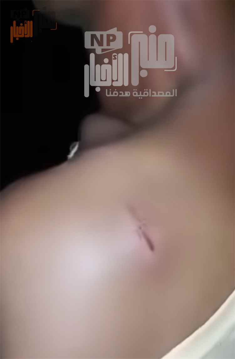 مطالبات بالتحقيق في واقعة اعتداء على مواطن واقتياده بالقوة في يختل بتعز