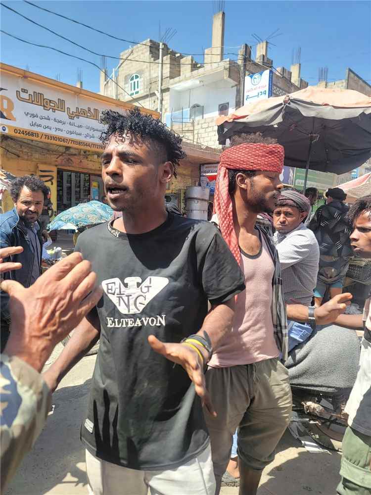 اعتداء في سوق دمت.. مواطن يتهم عصابة بمحاولة سرقته ويطالب الأمن بسرعة التحرك