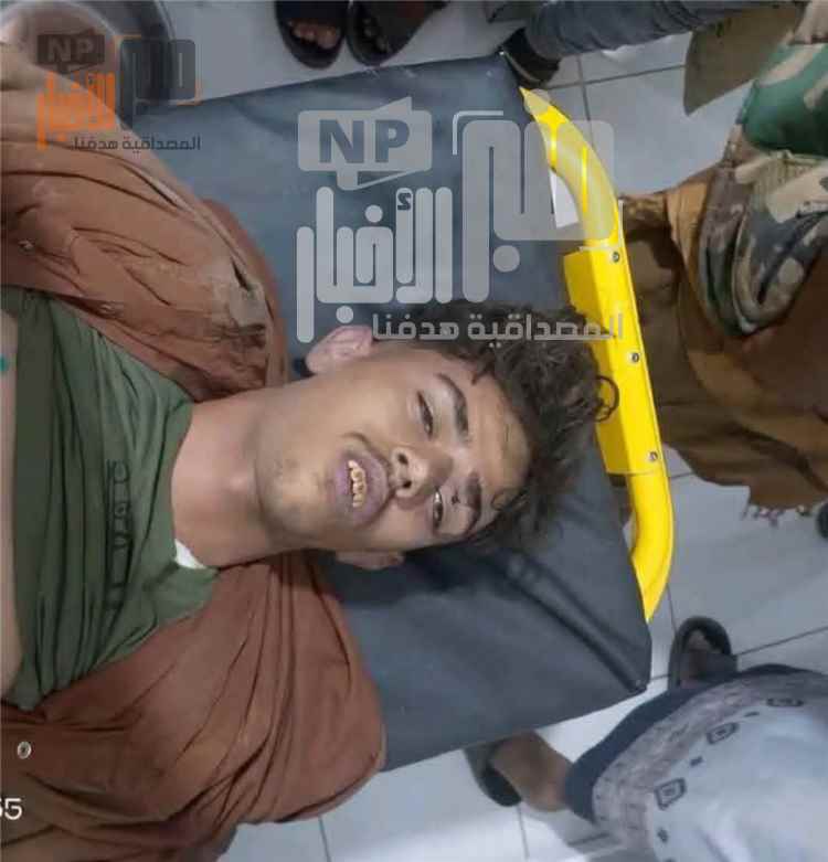 عاجل:الضالع..وفاة شخص في حادث مروري بدمت
