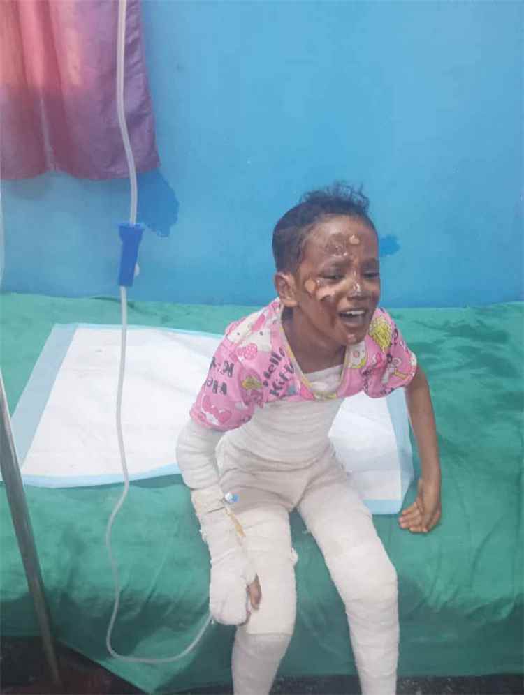 رحيل الطفلة فاطمة بعد معاناة الحريق يثير موجة حزن وانتقادات حول واقع الرعاية الصحية