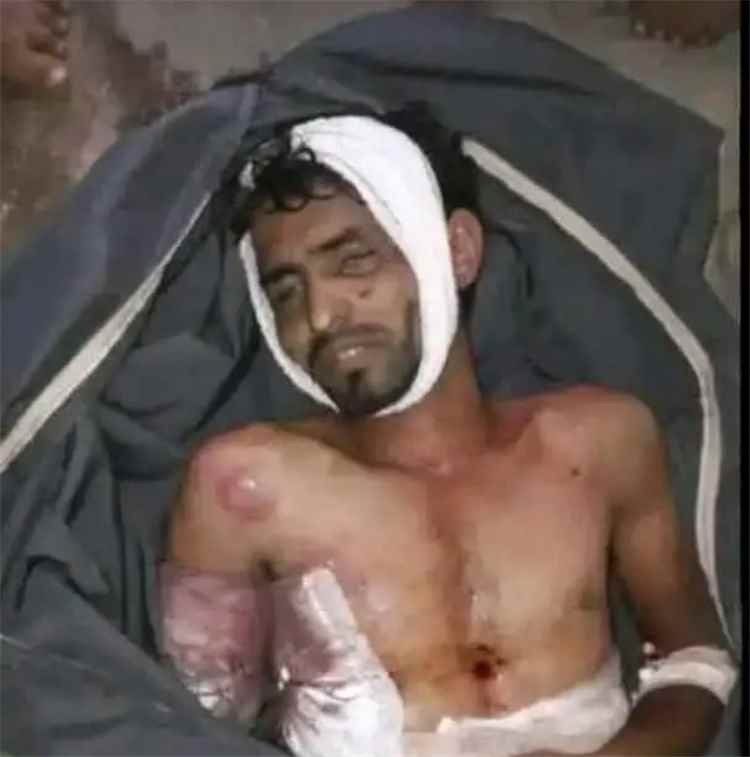 وفاة مختطف من تعز تحت التعذيب في المعتقلات الحو..ثية.