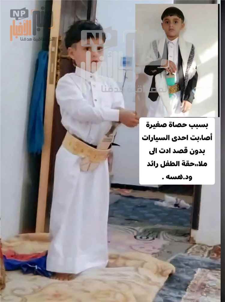 صنعاء:حصاة طائشة أصابت السيارة تنتهي بمأساة دامية.. وفاة الطفل رائد بعد شهر في العناية المركزة إثر ملاحقته ودهسه(تفاصيل صادمة)