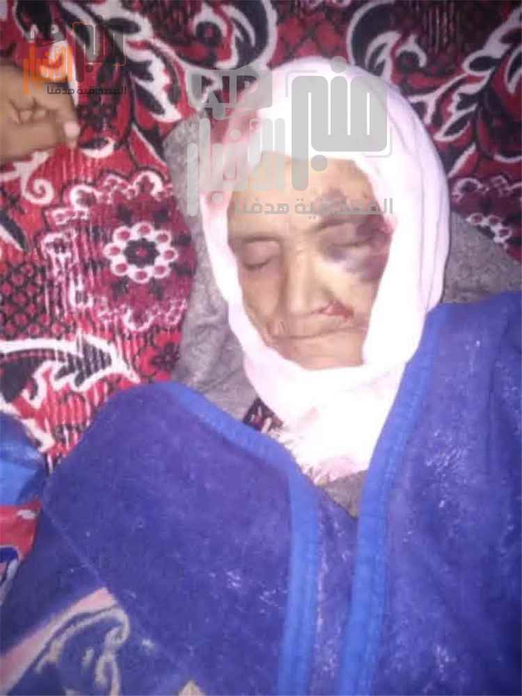 عاجل:الأمطار تحصد ضحية جديدة في تعز.. وفاة سيدة إثر انهيار منزل في جبل حبشي