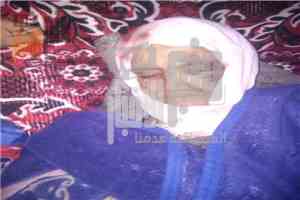 عاجل:الأمطار تحصد ضحية جديدة في تعز.. وفاة سيدة إثر انهيار منزل في جبل حبشي
