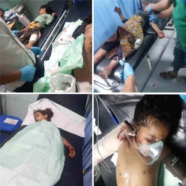 عاجل | محافظ الضالع يوجه باستنفار طبي لضحايا انفجار حوثي أودى بـ13 طفلاً بين شهيد وجريح ويدعو إلى تحرك دولي لإنهاء خطر مخلفات الحرب