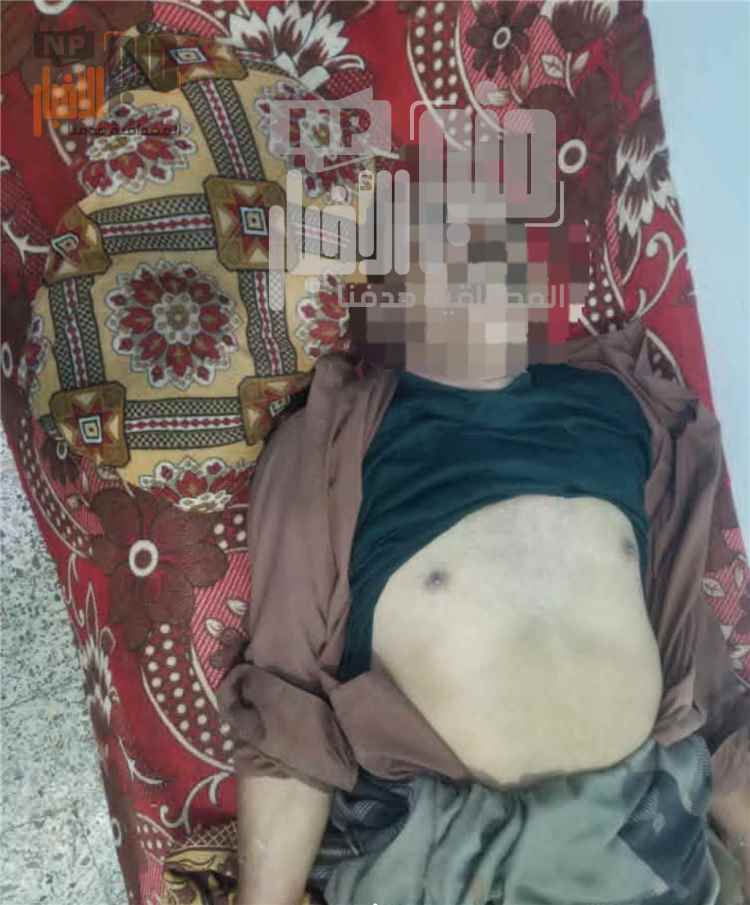 ذمار..صاعقة رعدية تودي بحياة تربوي في وصاب السافل
