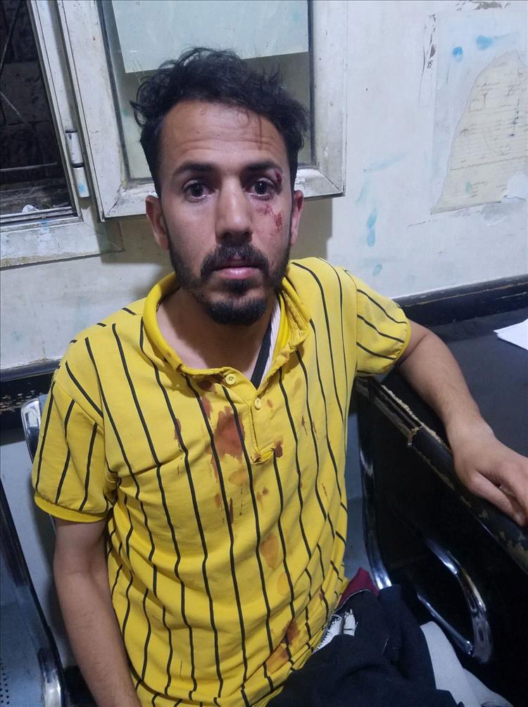 اعتداء صادم يهز الملاعب اليمنية.. مطالبات بمعاقبة وحدة صنعاء بعد إصابة حكم بكسر في الأنف