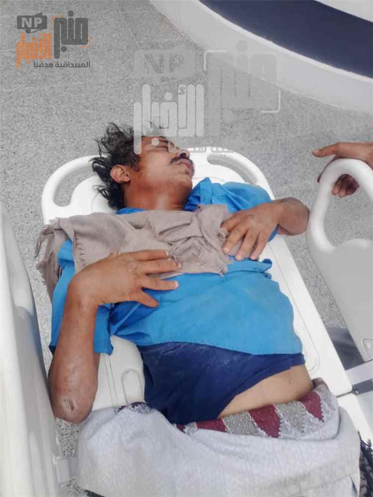 عاجل: فيما السائق لاذ بالفرار..حادث دهس غامض في عتق شبوة ومناشدات عاجلة للوصول إلى أسرة المصاب