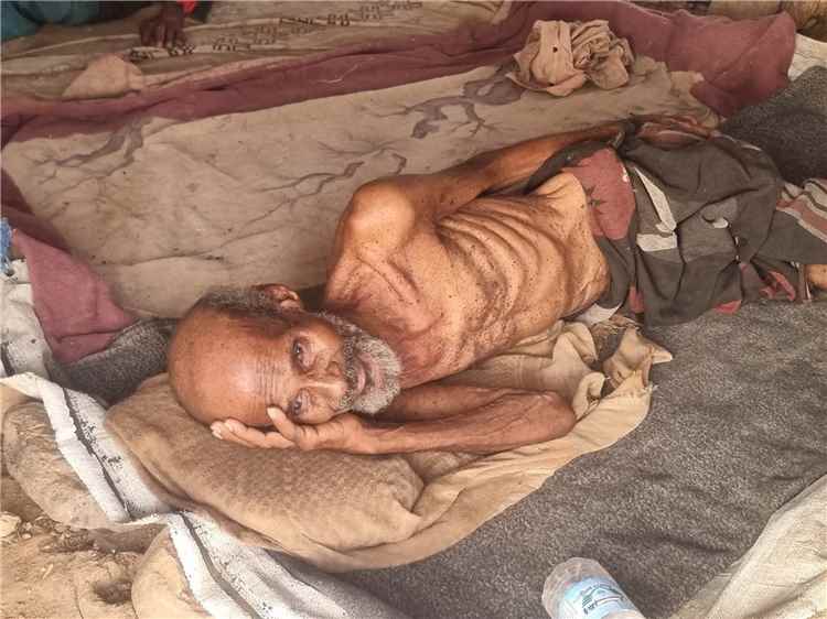 المجاعة تحصد الأرواح في مخيمات النزوح بتهامة.. وفاة مسن في مخيم عبس بمحافظة حجة