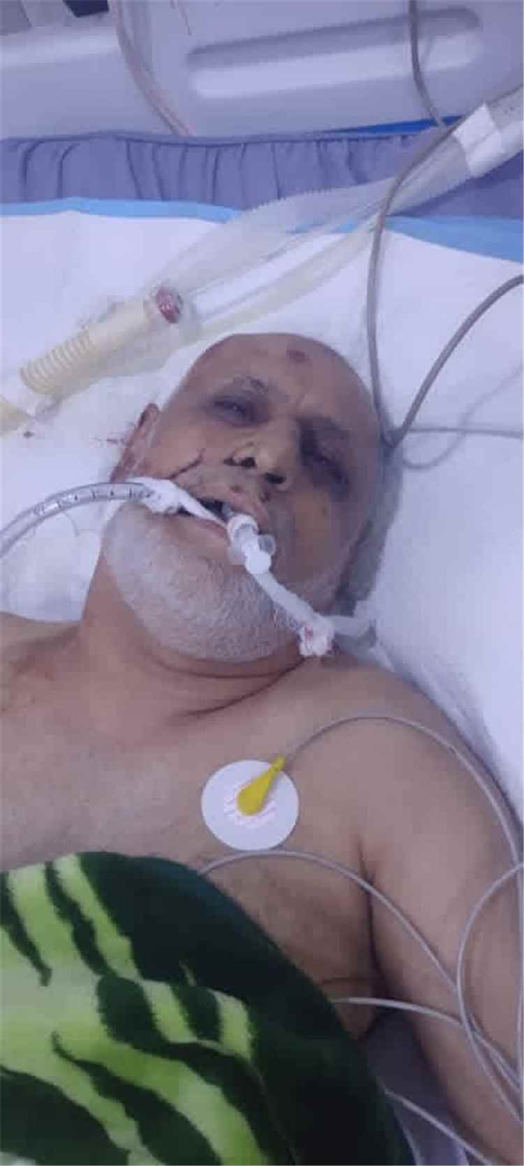 مناشدة للتعرف على هويته.. مجهول يرقد بالعناية المركزة بعد تعرضه لحادث دهس في المنصورة