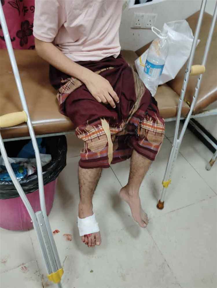 عاجل: اعتداء دموي على طلاب من أبناء المخا داخل سكنهم بمدينة تعز ونقل عدد منهم إلى المستشفى(صور)