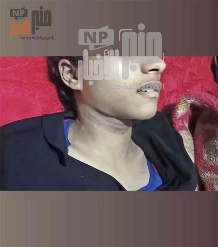 عاجل:بعيداً عن الإعلام..هذا ماحدث في ريمة (صورة مرعبة)