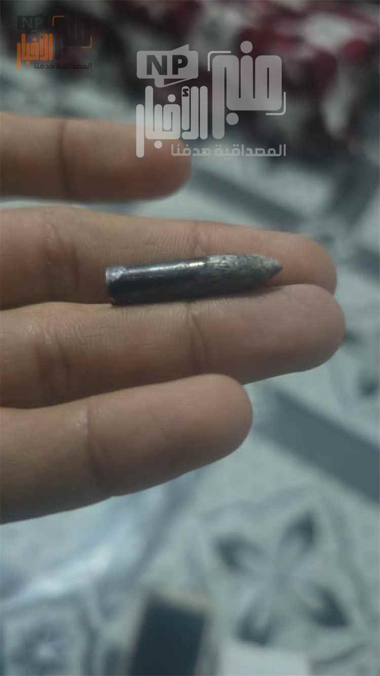 عاجل:صور مرعبة من المسراخ..شاهد قناص كيف أراد قتل أسرة قي تعز