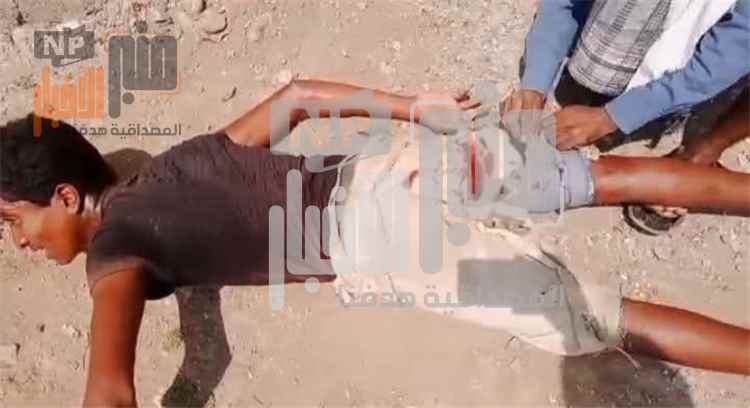 عاجل: إصابة مواطن بطلق ناري خلال اعتداء  لمليشيا الح~وثي بالاستيلاء على أراضي المواطنين