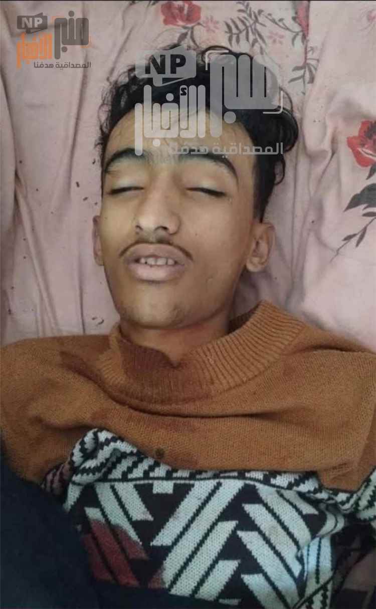 لهذا السبب.. ملي~شيا الح~وثي تقوم بتصفية الطفل عمار ياسر في تعز