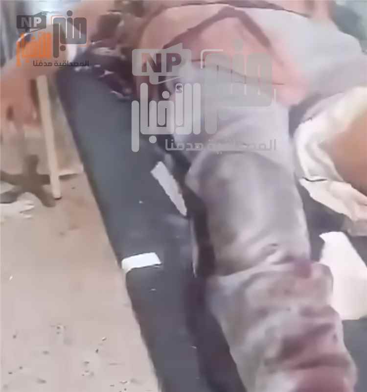 عاجل: أربعة شهداء وأكثر من 10 جرحى في قصف صاروخي استهدف رأس العارة بلحج