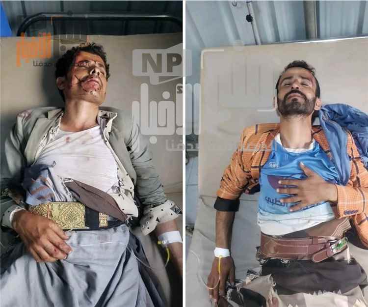 عاجل:سقوط قتلى وجرحى..هذا ماحدث في ذمار (صورة)