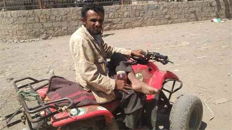 ردفان.. وفاة متعب من القشعة بعد سنوات من الكفاح لإعالة أسرته