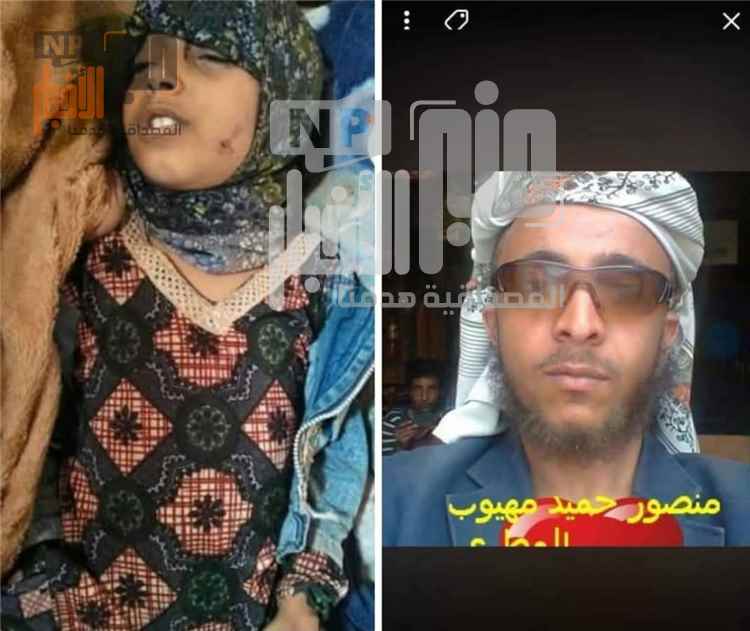 عاجل:هذا ماحدث في إب