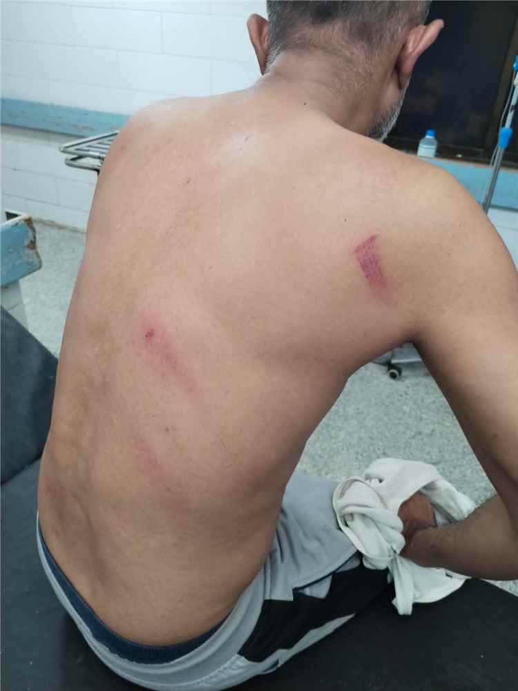 عاجل: المحامي نزار سرارو يوجه بلاغا إلى مدير أمن عدن بشأن اعتداء ورفض ضبط المتهمين