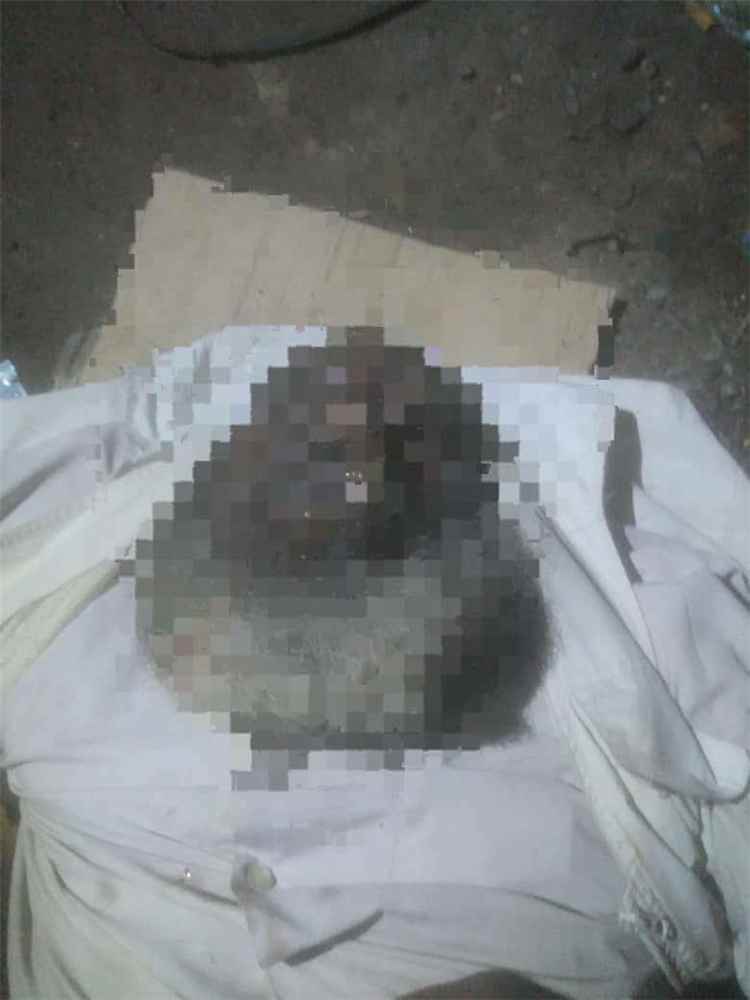 العثور على جثة رجل مصري بالقرب من جولة كالتكس في المنصورة